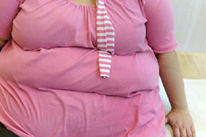 有一种励志叫贾玲减肥成功！唯一拼过贾玲减肥方式——袖状胃切除术